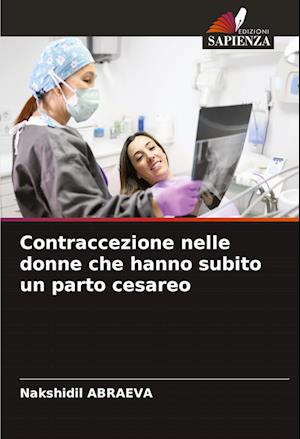 Contraccezione nelle donne che hanno subito un parto cesareo