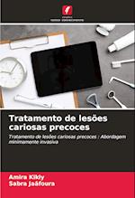 Tratamento de lesões cariosas precoces