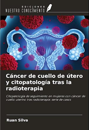 Cáncer de cuello de útero y citopatología tras la radioterapia