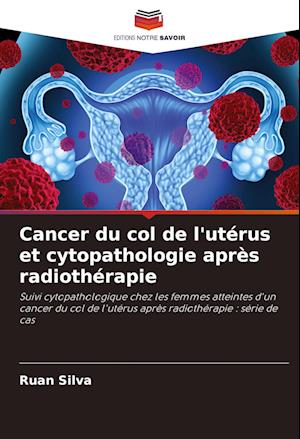 Cancer du col de l'utérus et cytopathologie après radiothérapie