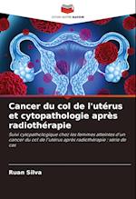 Cancer du col de l'utérus et cytopathologie après radiothérapie