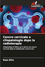 Cancro cervicale e citopatologia dopo la radioterapia