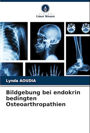 Bildgebung bei endokrin bedingten Osteoarthropathien