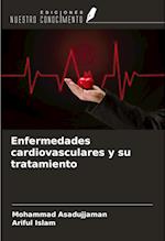 Enfermedades cardiovasculares y su tratamiento