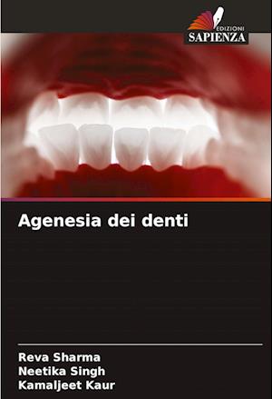 Agenesia dei denti