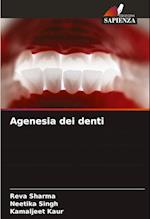 Agenesia dei denti