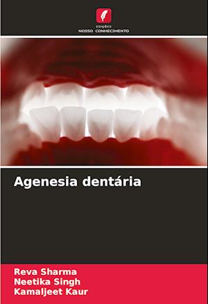 Agenesia dentária