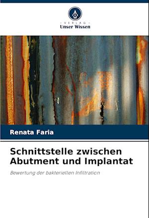 Schnittstelle zwischen Abutment und Implantat