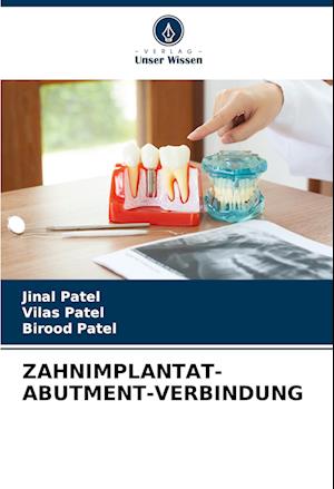 ZAHNIMPLANTAT-ABUTMENT-VERBINDUNG