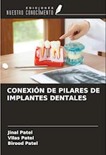 CONEXIÓN DE PILARES DE IMPLANTES DENTALES