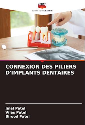 CONNEXION DES PILIERS D'IMPLANTS DENTAIRES