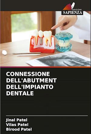 CONNESSIONE DELL'ABUTMENT DELL'IMPIANTO DENTALE