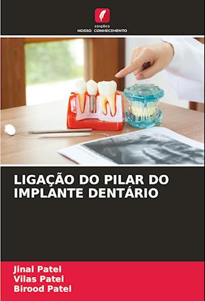 LIGAÇÃO DO PILAR DO IMPLANTE DENTÁRIO