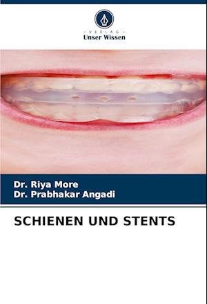 SCHIENEN UND STENTS