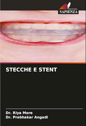 STECCHE E STENT