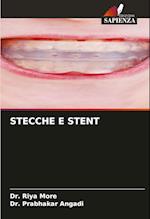 STECCHE E STENT