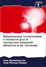 Proqwleniq talassemii w polosti rta i chelüstno-licewoj oblasti i ih lechenie