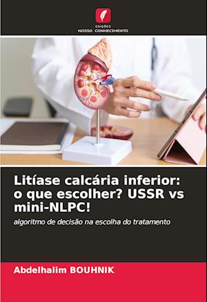 Litíase calcária inferior: o que escolher? USSR vs mini-NLPC!