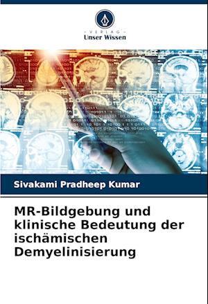 MR-Bildgebung und klinische Bedeutung der ischämischen Demyelinisierung