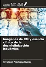 Imágenes de RM y esencia clínica de la desmielinización isquémica