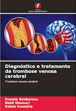 Diagnóstico e tratamento da trombose venosa cerebral