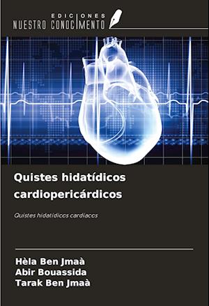 Quistes hidatídicos cardiopericárdicos