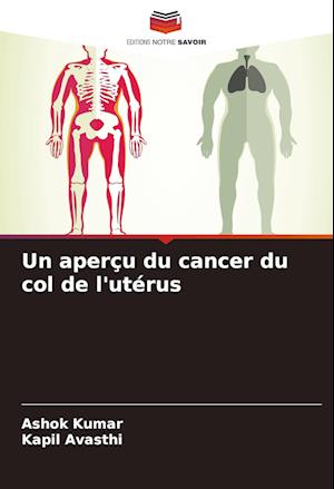 Un aperçu du cancer du col de l'utérus