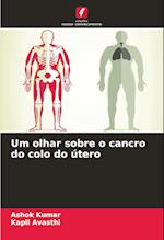 Um olhar sobre o cancro do colo do útero