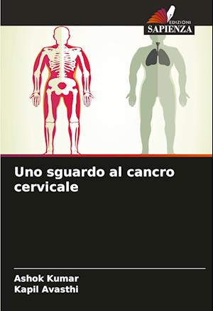 Uno sguardo al cancro cervicale