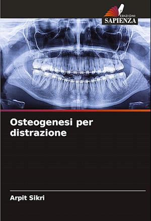 Osteogenesi per distrazione