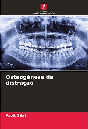 Osteogénese de distração