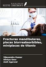 Fracturas mandibulares, placas biorreabsorbibles, miniplacas de titanio