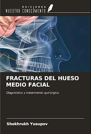 FRACTURAS DEL HUESO MEDIO FACIAL