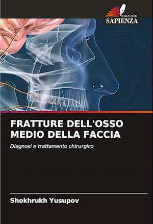 FRATTURE DELL'OSSO MEDIO DELLA FACCIA