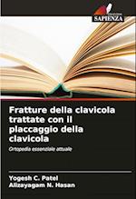 Fratture della clavicola trattate con il placcaggio della clavicola