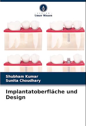 Implantatoberfläche und Design