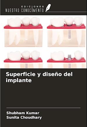 Superficie y diseño del implante