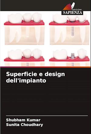 Superficie e design dell'impianto