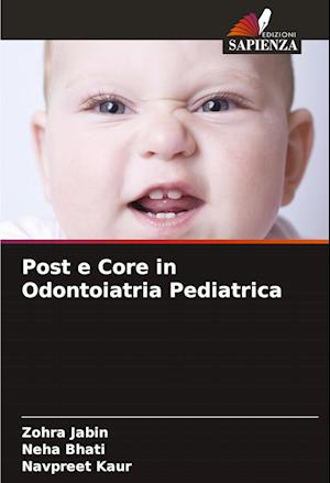 Post e Core in Odontoiatria Pediatrica