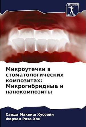 Mikroutechki w stomatologicheskih kompozitah: Mikrogibridnye i nanokompozity