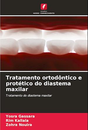 Tratamento ortodôntico e protético do diastema maxilar