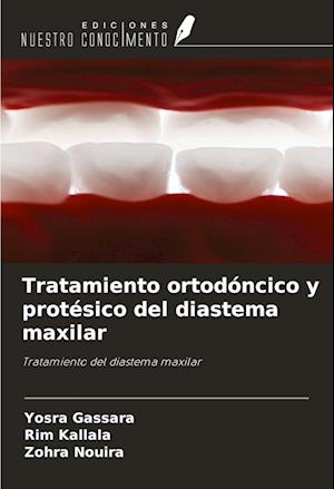 Tratamiento ortodóncico y protésico del diastema maxilar