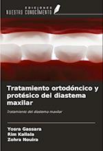 Tratamiento ortodóncico y protésico del diastema maxilar