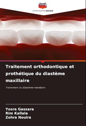 Traitement orthodontique et prothétique du diastème maxillaire