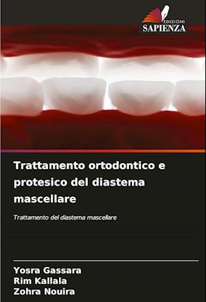 Trattamento ortodontico e protesico del diastema mascellare