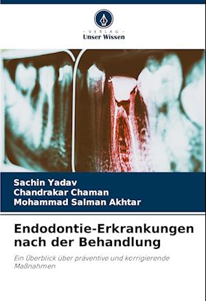 Endodontie-Erkrankungen nach der Behandlung