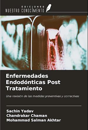 Enfermedades Endodónticas Post Tratamiento