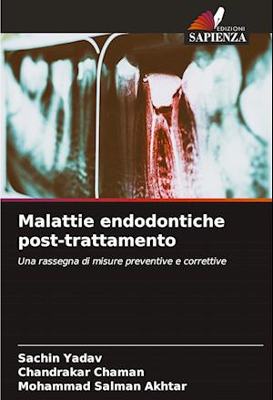 Malattie endodontiche post-trattamento