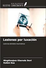 Lesiones por luxación