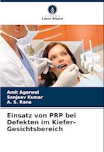 Einsatz von PRP bei Defekten im Kiefer-Gesichtsbereich